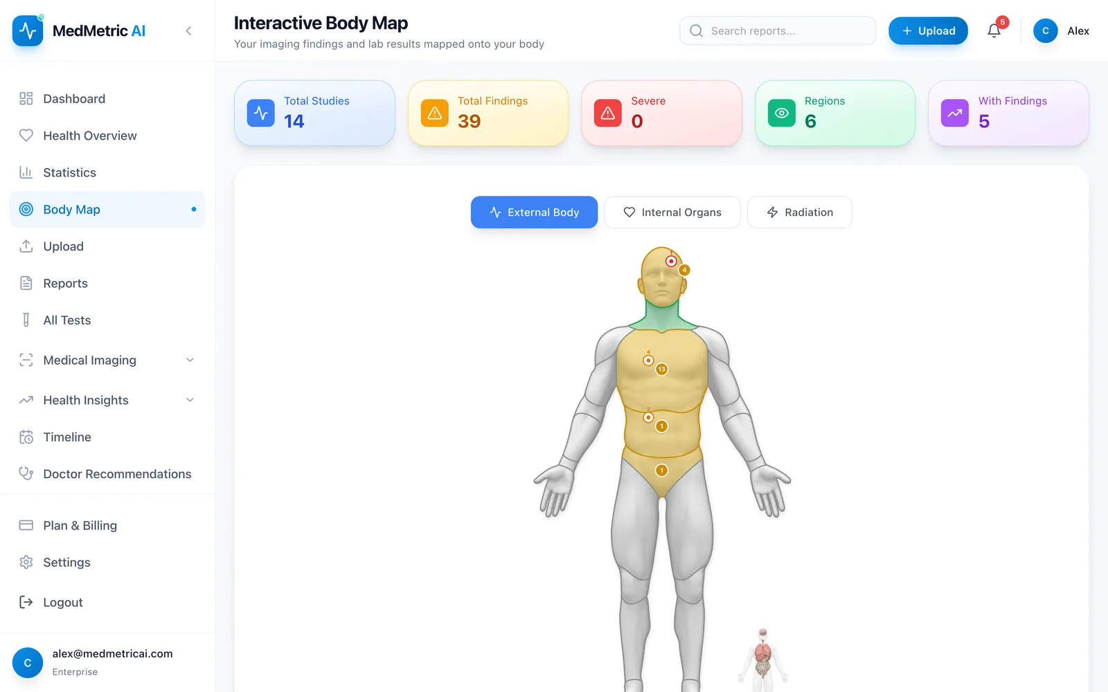 Interactive body map with findings pinned to the organs they affect and a detail panel for the selected region